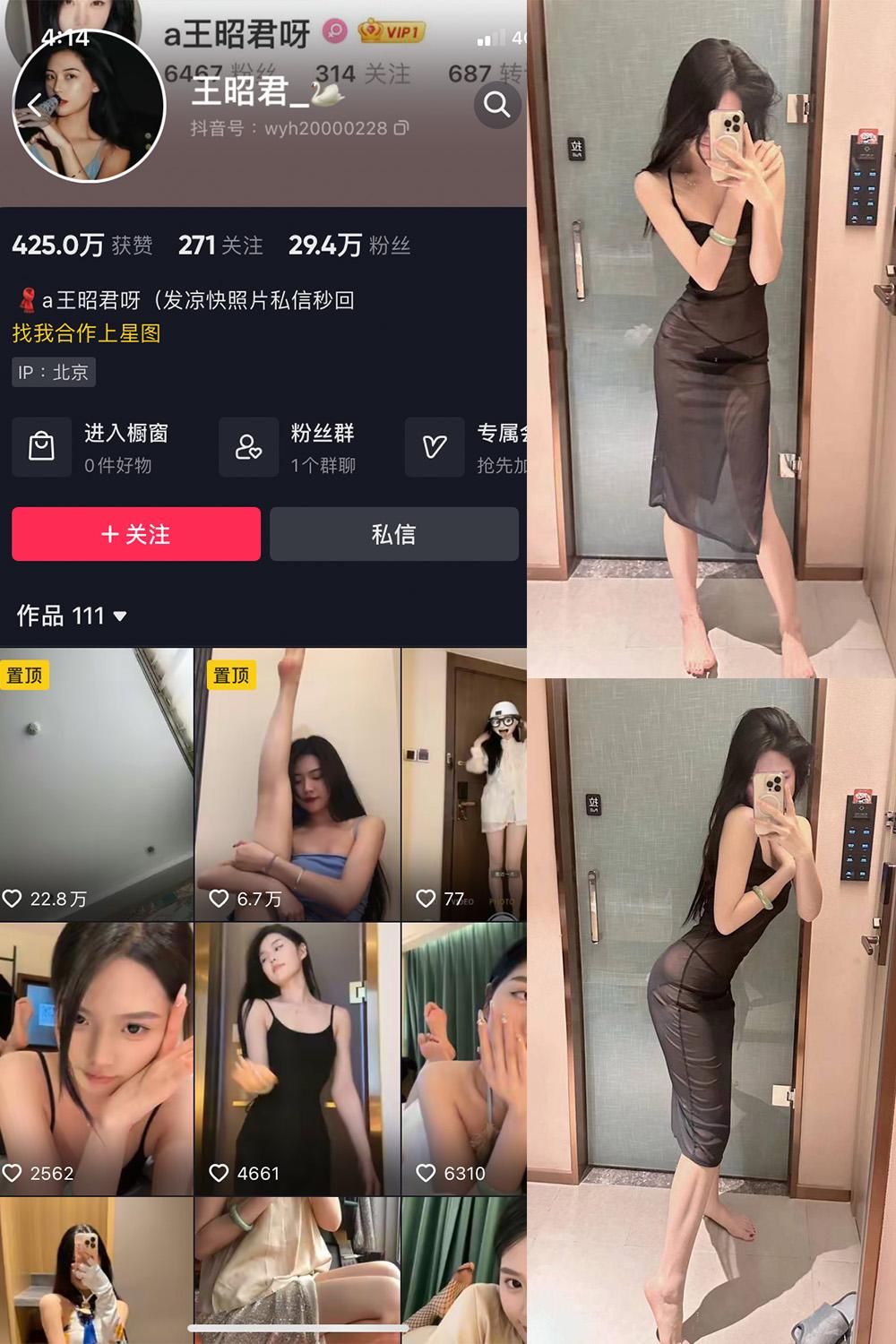 抖音 王昭君 微密圈视图  NO.004期 【10P1V】