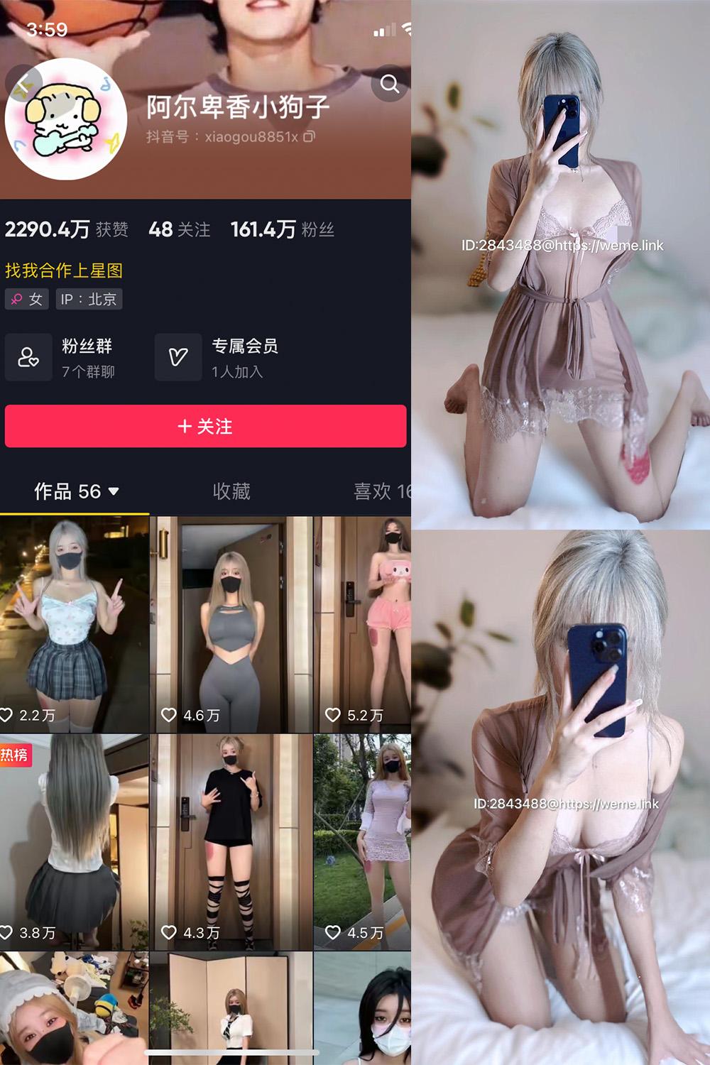 抖音 阿尔卑香小狗子 微密圈视图  NO.016期 【33P】
