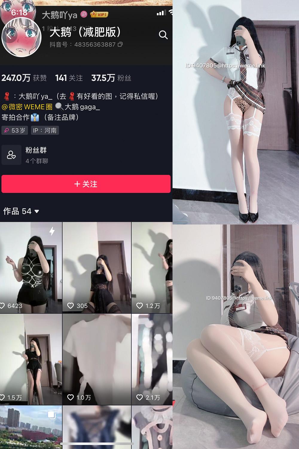 抖音 大鹅 微密圈视图 NO.005期 【15P】