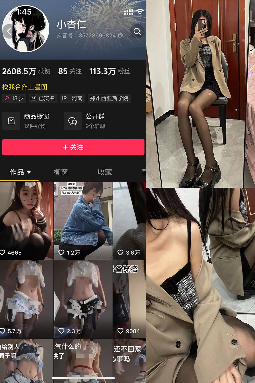 抖音 小杏仁 微密圈视图  NO.007 【61P】