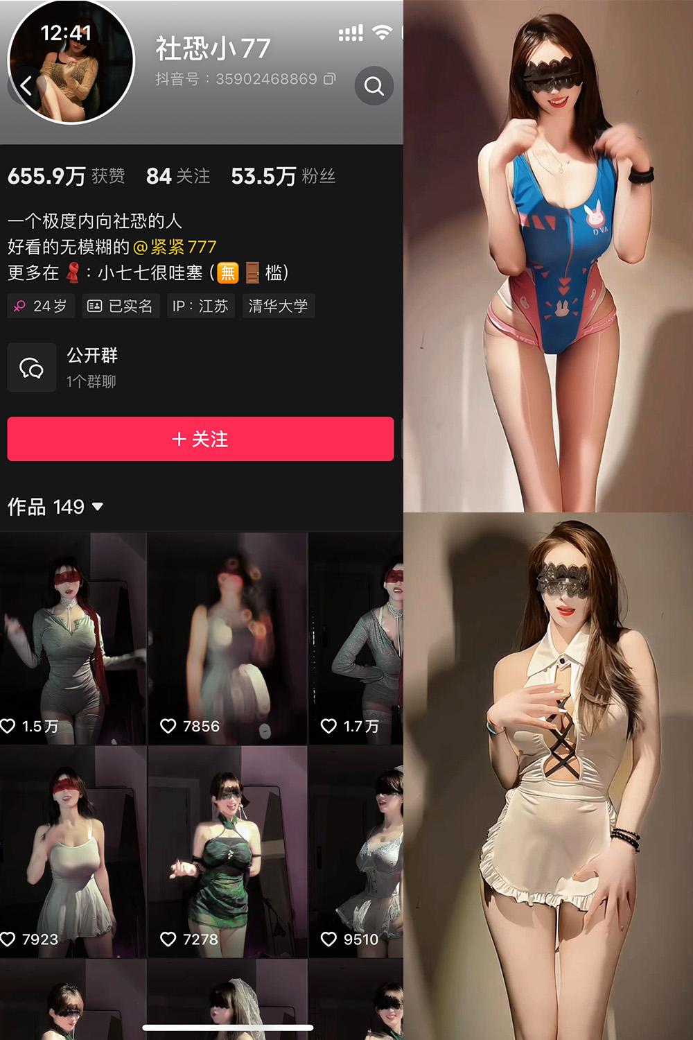 抖音 社恐小77 微密圈视图 002期 【20V】