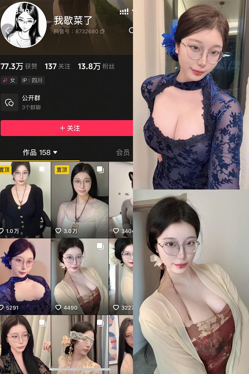 抖音 我歇菜了 微密圈视图 NO.001期 【10P】