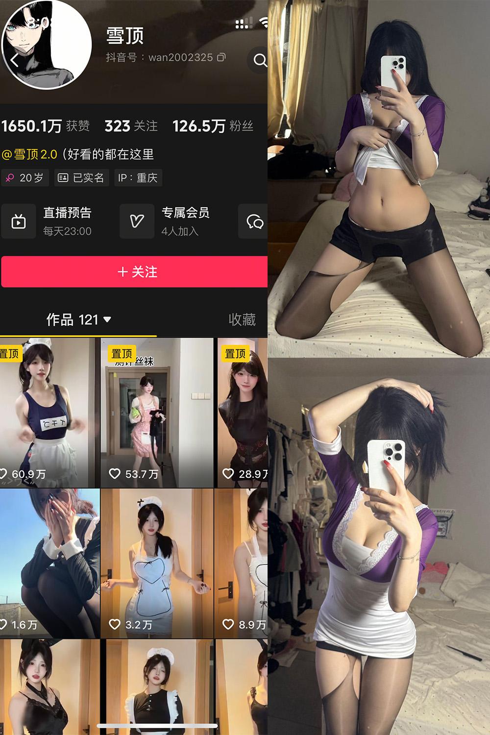抖音 雪顶 岛遇资源 NO.005期 【30P】